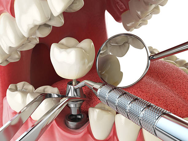 Professional Emergency Dental Service in WA